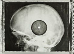 A secret record collection, stored on x-rays